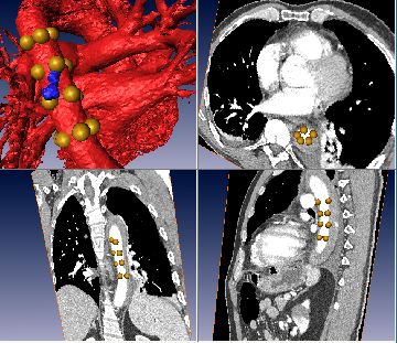 stent_planning.jpg