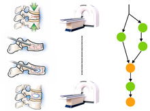 Discovery and Detection of Surgical Activity in Percutaneous Vertebroplasties