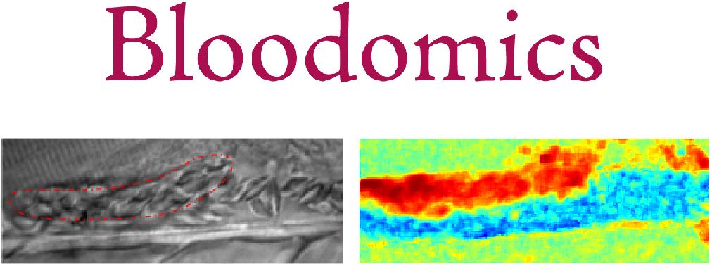 Automatic thrombus segmentation in in vivo micoscopic video sequences under low contrast and highly dynamic conditions