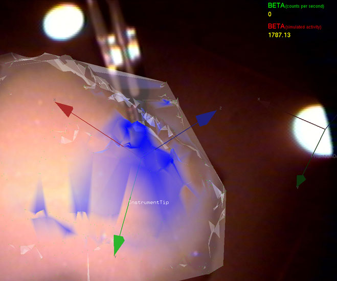 Intra-operative Beta Probe Surface Imaging and Navigation for Optimal Tumor Resection