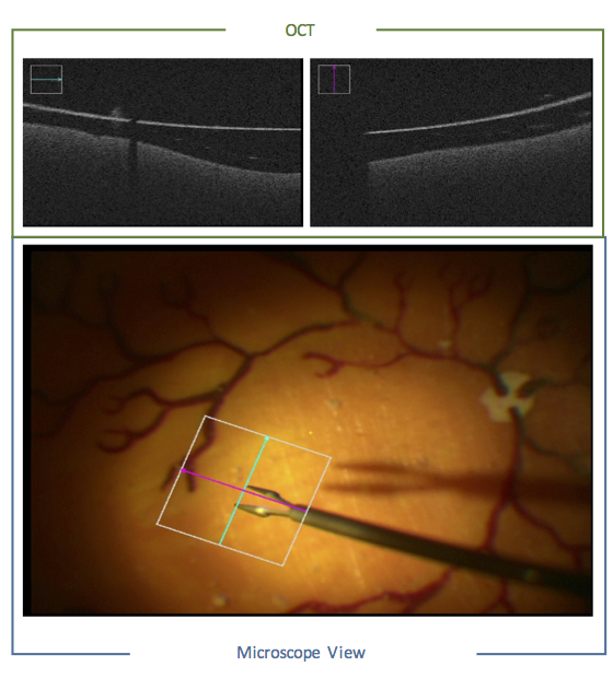 Computer-Aided Ophthalmic Procedures  