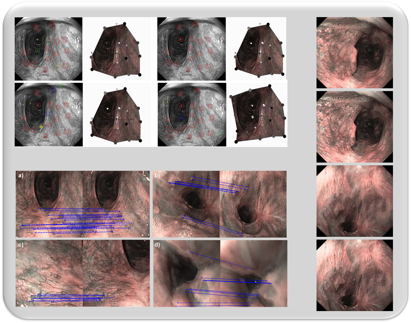 Endoscopic Video Processing