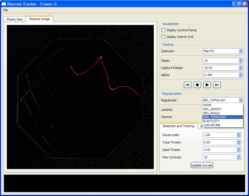 Deformable Guide Wire Tracking