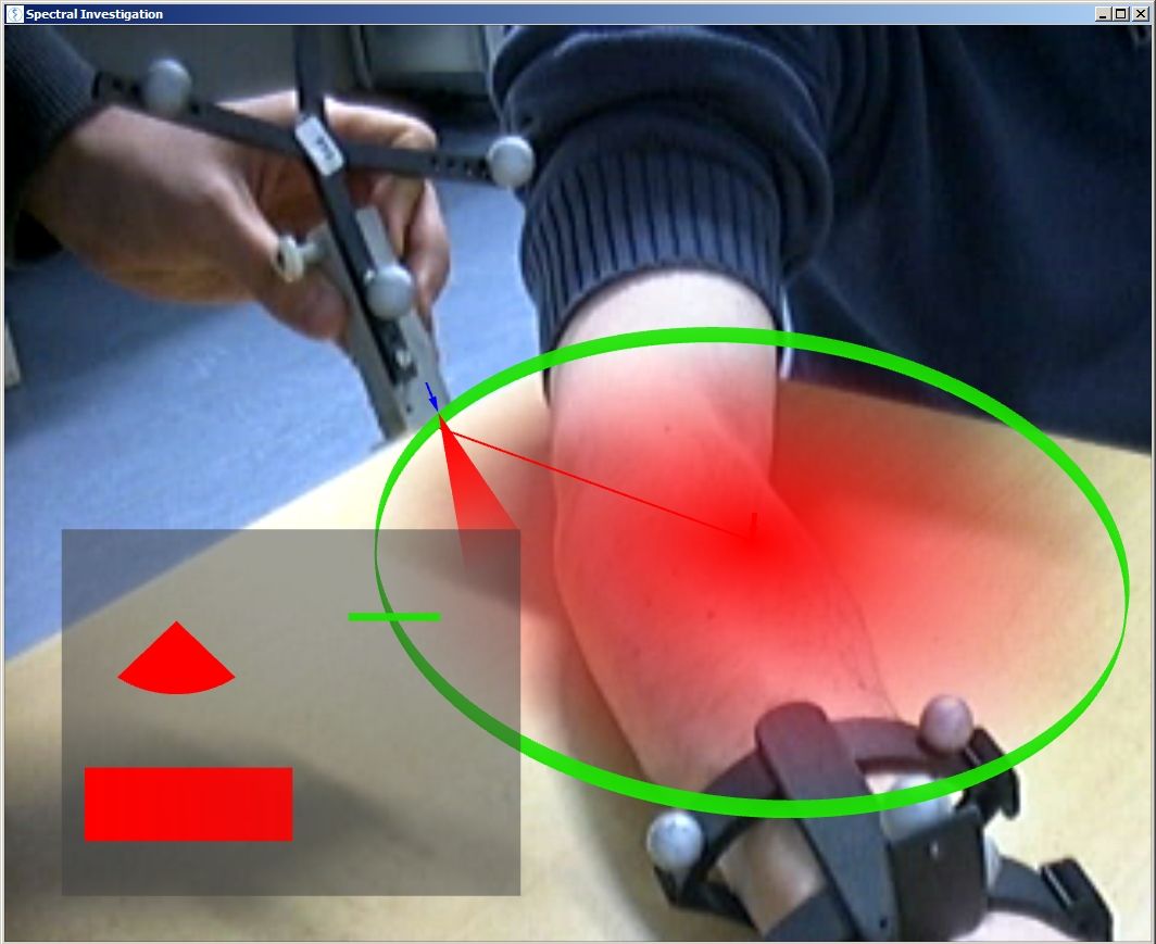 Automatic Progression Tracking of Skin Lesions