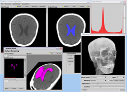 SUSI 2.0 - The Next Segmentation