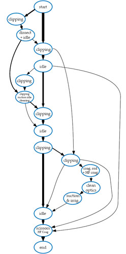 Graphical representation of surgical workflow