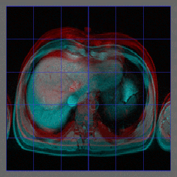 liver_animation_small.gif