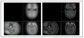 Image of 3D segmented breast