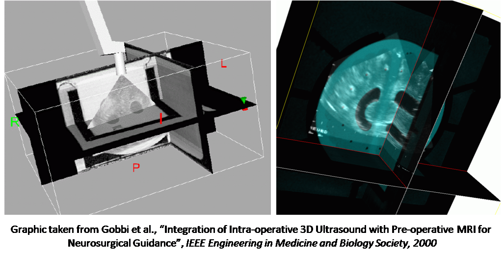Image of 3D segmented breast