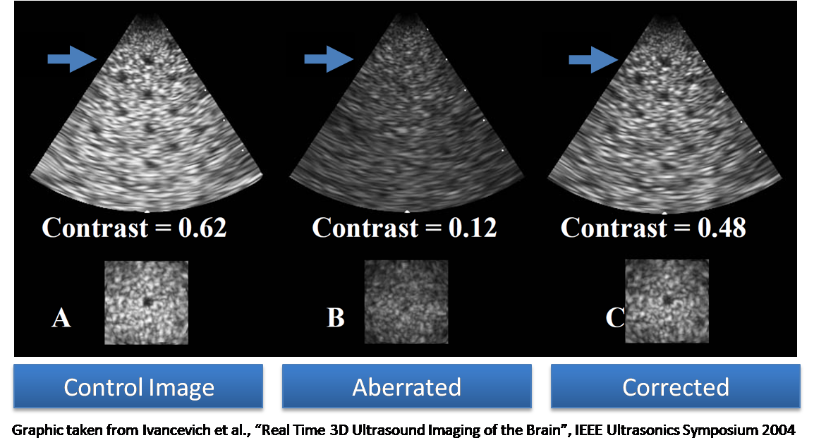 Image of 3D segmented breast
