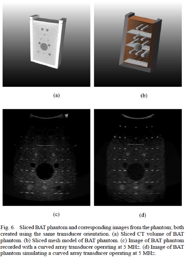 Possible quality of convolution-based ultrasound simulation (taken from Buerger et al., 2012, see project description).
