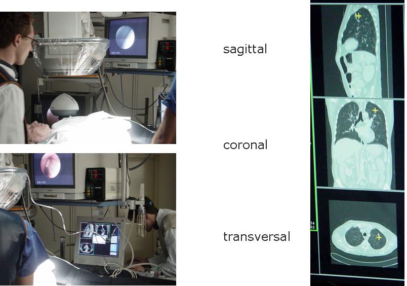 navigated_bronchoscopy.JPG